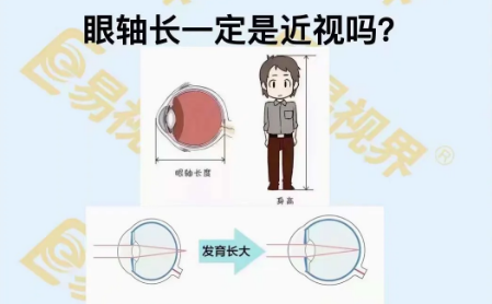 眼軸長一定是近視嗎?