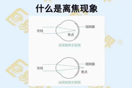 什么是離焦現象