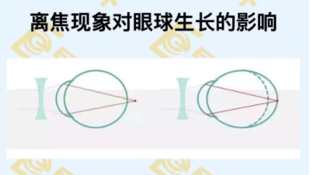 什么是離焦現象