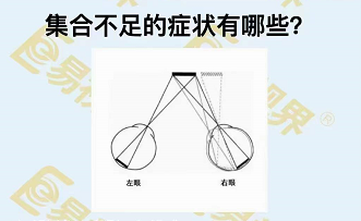 集合不足的癥狀有哪些？